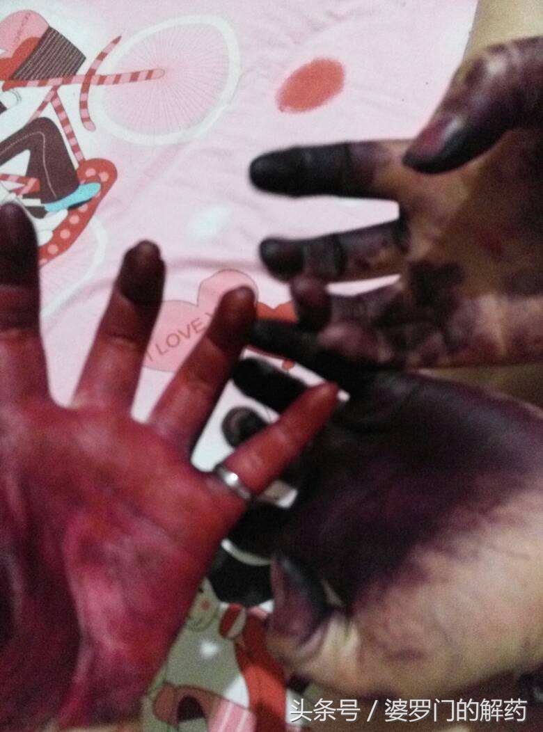 经常染发的女人对身体有害吗,经常染发的女生需要注意以下几点