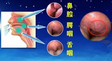 男子打鼾一夜呼吸停断,男人喝完酒打呼噜窒息