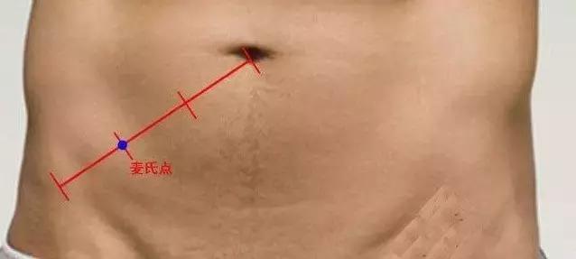 腹痛的辨证范畴,腹痛鉴别