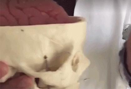 头部撞击会损坏大脑么,头颅撞击会有什么状况