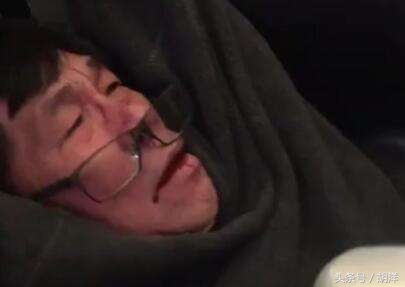 头部撞击会损坏大脑么,头颅撞击会有什么状况