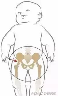 小孩x型腿和o型腿的鉴别,宝宝o型腿是髋关节有问题么