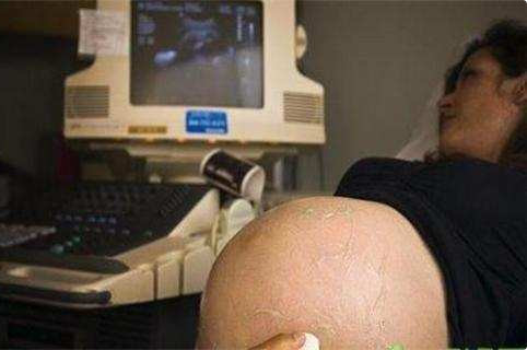 孕妇孕期病症,孕期孕妇好多问题