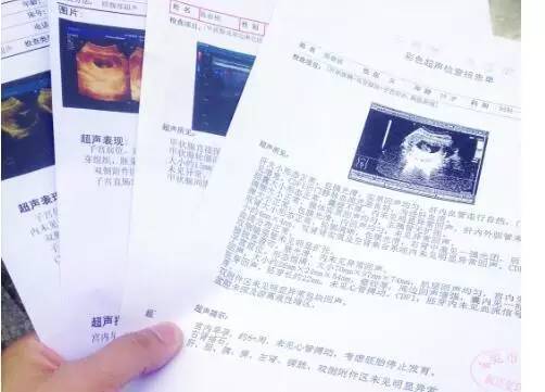 愤怒!医生渎职酿悲剧,孕妈一定要懂得胎动常识