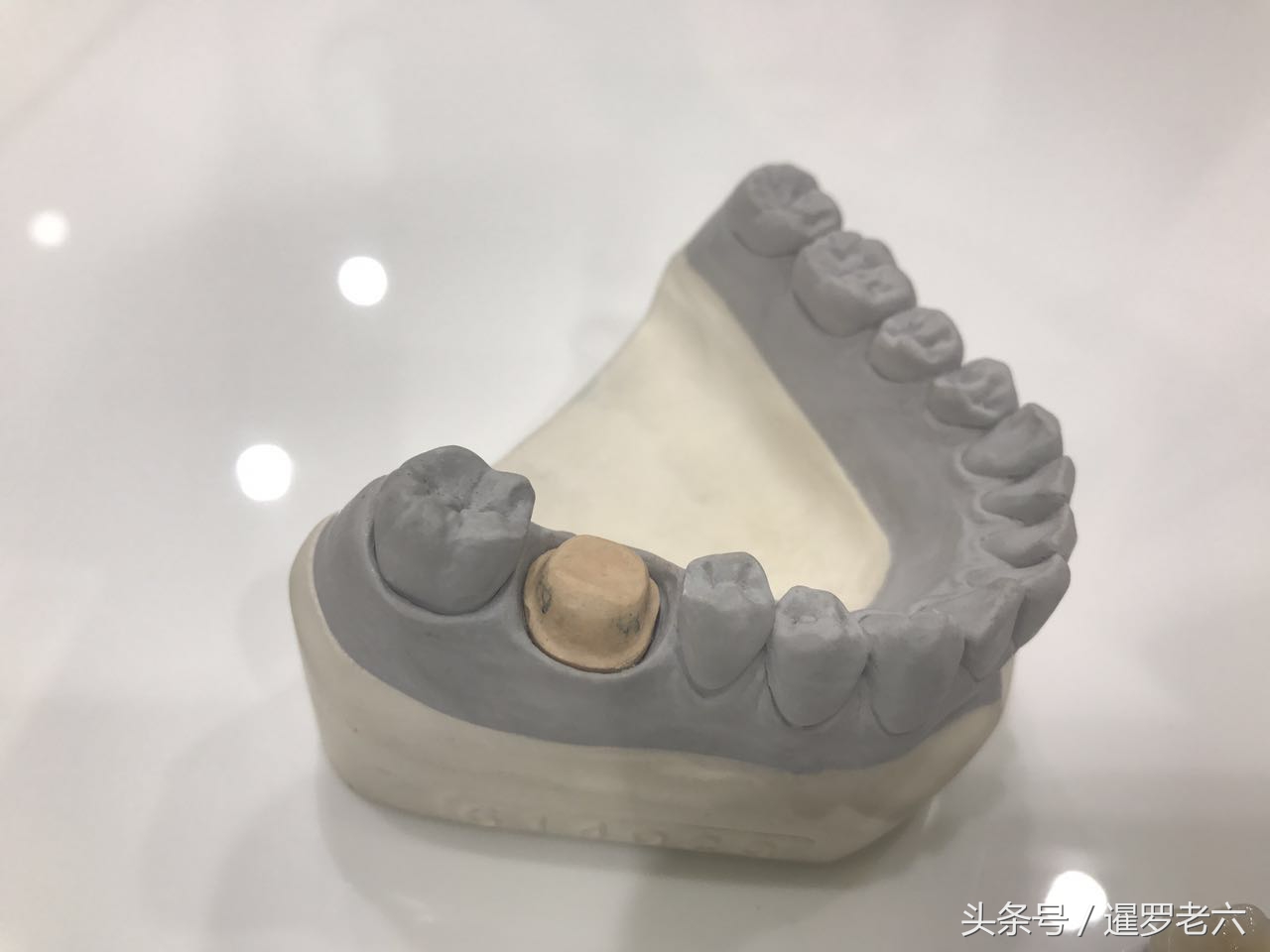 泰国曼谷医院补牙哪家好,在泰国曼谷做美白牙齿价格多少