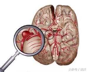 头部撞击会损坏大脑么,头颅撞击会有什么状况