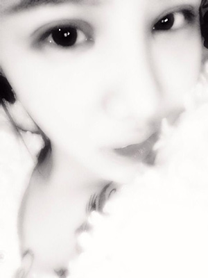 双眼皮手术后修复视频,双眼皮手术恢复记录视频