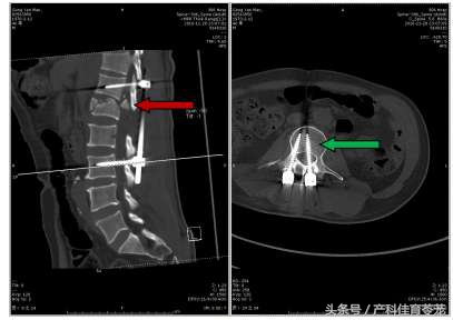 厉害了,这些骨科医生——306医院骨科成功救治非洲务工者