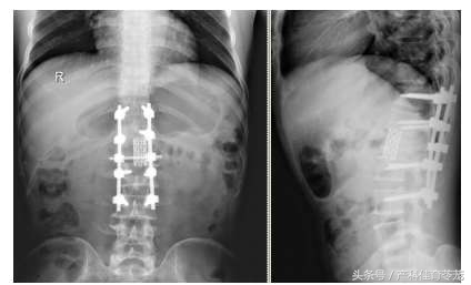 厉害了,这些骨科医生——306医院骨科成功救治非洲务工者