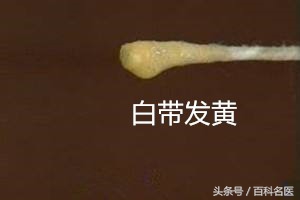 已婚女性的正常白带是怎样的,女性白带多科普