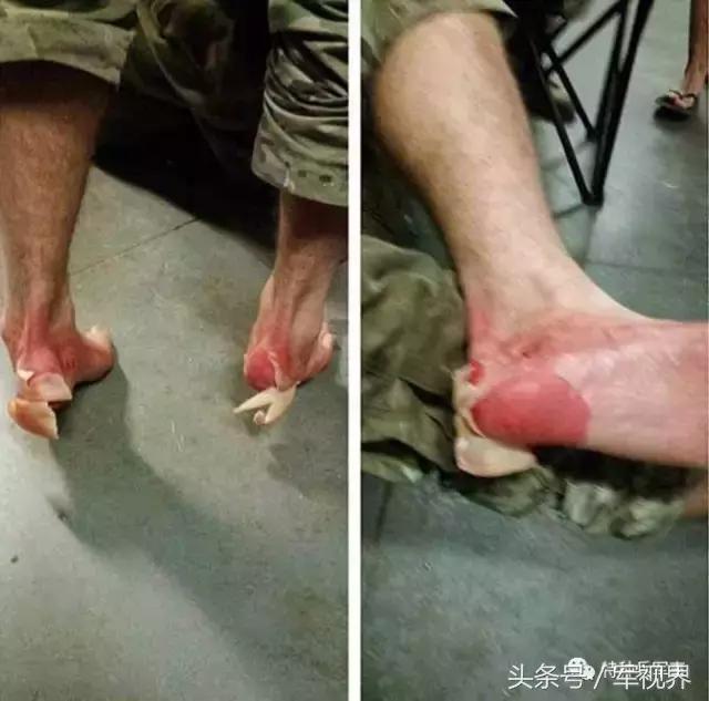 美国游骑兵战术,一张刺激战场照片