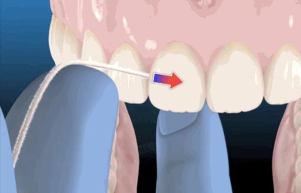 一辈子不洗牙的危害,一辈子不洗牙会有什么后果