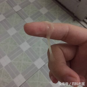 已婚女性的正常白带是怎样的,女性白带多科普