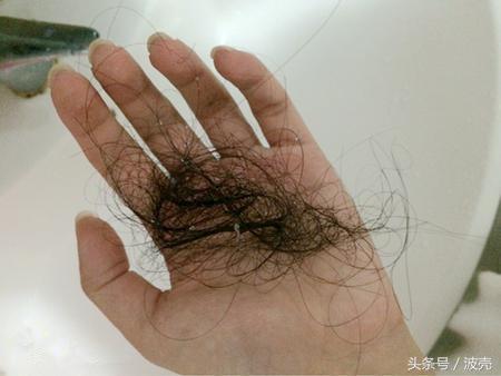 生孩子为什么要刮皮,生孩子时剃掉了头发