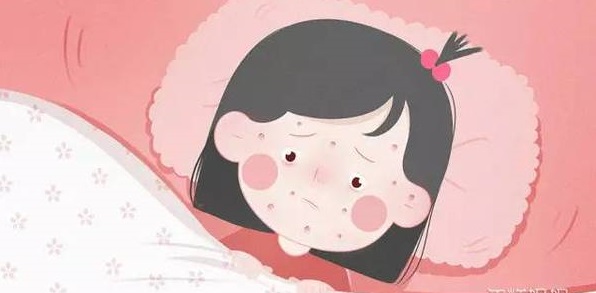 小儿出疹性疾病鉴别,小儿常见出疹性疾病的表现和护理