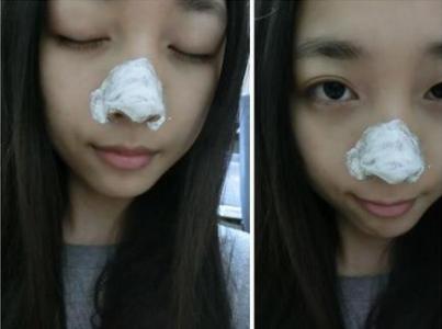 去黑头毛孔粗大的产品医生推荐,用撕拉黑头贴去黑头导致毛孔粗大