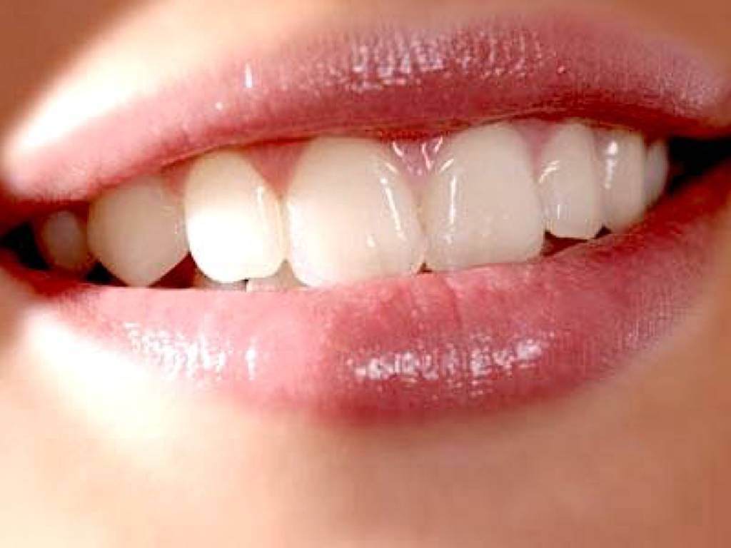 一辈子不洗牙的危害,一辈子不洗牙会有什么后果