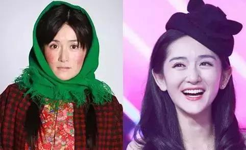 红血丝泛红怎么改善,红血丝肌肤怎么治