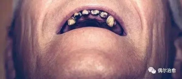 牙齿对人面貌的影响,一张图让你明白牙齿影响全身健康