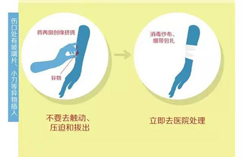 外伤引起肺部感染,怎样防止外伤的发生