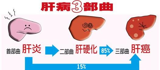 肝硬化可逆转吗?老中医实例验案来解答,助你把肝“软”下来