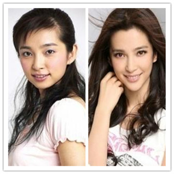 如何治疗脸盲症,如何克服脸盲症