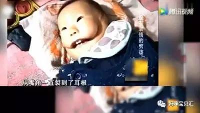 孕妇在下雨天生下怪胎,因劳累生出重疾宝宝