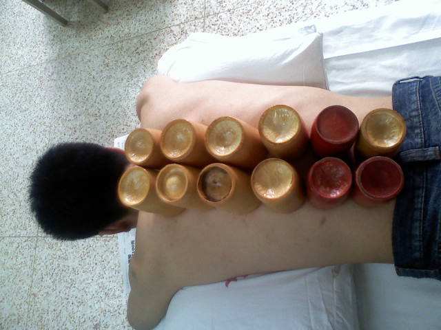 背痛有很多,伤筋最常见,这些方法很管用,但却很少人知道!