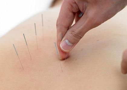 背痛有很多,伤筋最常见,这些方法很管用,但却很少人知道!