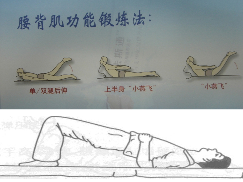 背痛有很多,伤筋最常见,这些方法很管用,但却很少人知道!