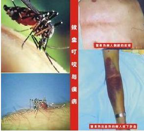 历史上的瘟疫传染病,历史上疫情持续时间最长的瘟疫