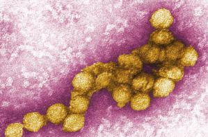 历史上的瘟疫传染病,历史上疫情持续时间最长的瘟疫