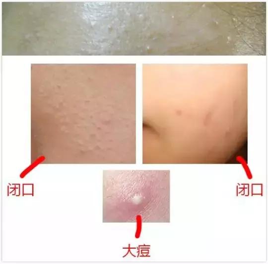 「闭口」这个小婊砸,怎么比现任的前任更难缠!