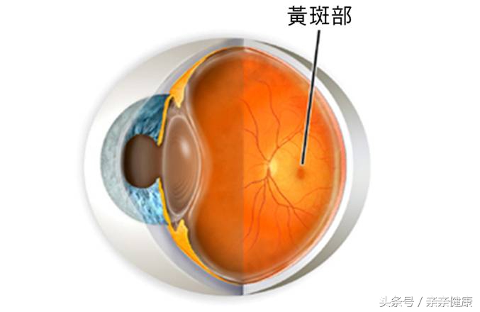黄斑裂孔怎么治疗,黄斑出血和黄斑裂孔的区别