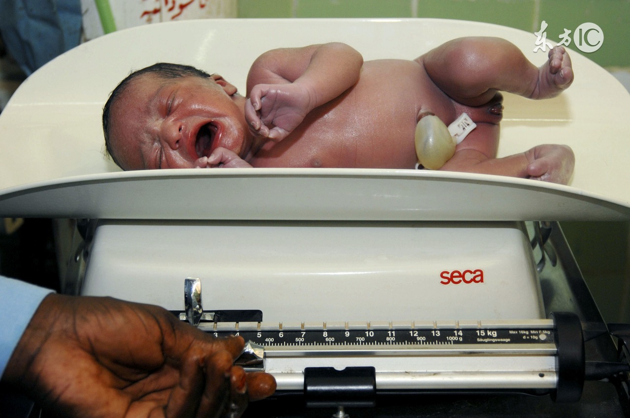 破水四天听助产士的还是听医生的,破水厉害如何待产