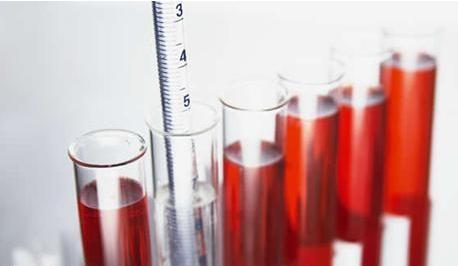 尿液变颜色了是什么情况,尿液黄怎么回事是上火还是肾不好