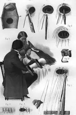 人类历史上匪夷所思的人体实验,历史上真实的人体实验