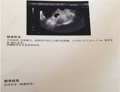 孩子肚子查不出原因是怎么回事,宝宝体检过后肚子不舒服