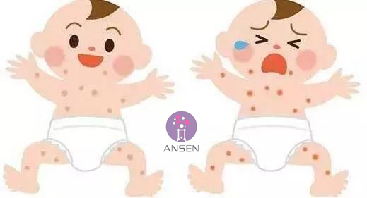 婴儿湿疹克星一览表,湿疹不用怕3个小妙招轻松应对