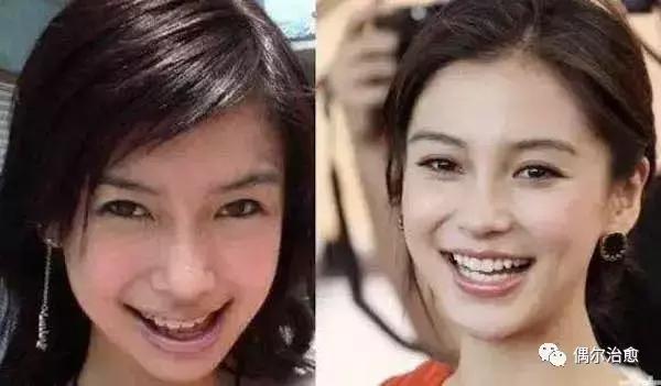 牙齿对人面貌的影响,一张图让你明白牙齿影响全身健康