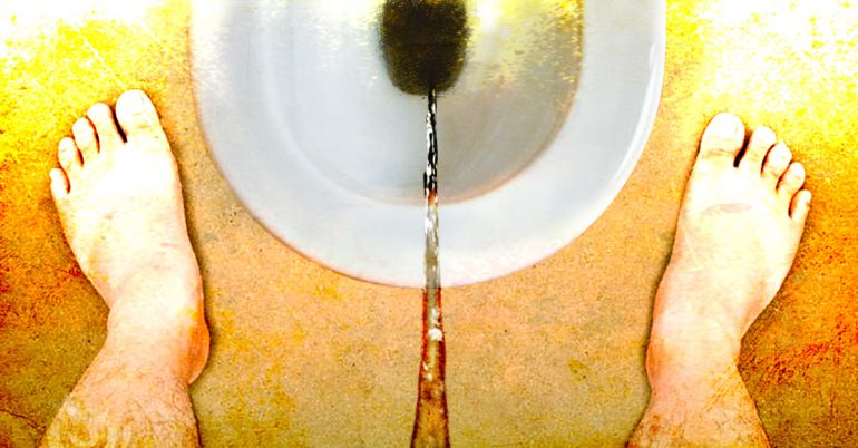 尿液变颜色了是什么情况,尿液黄怎么回事是上火还是肾不好