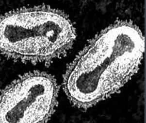 历史上的瘟疫传染病,历史上疫情持续时间最长的瘟疫