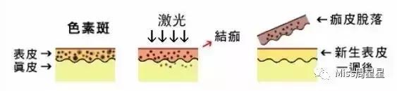 专家来告诉你美容仪真的管用吗,美容仪真的有用吗运用了哪些原理