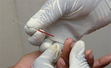 艾滋病晚期临死10天症状自述,艾滋病发病期症状的自述100例