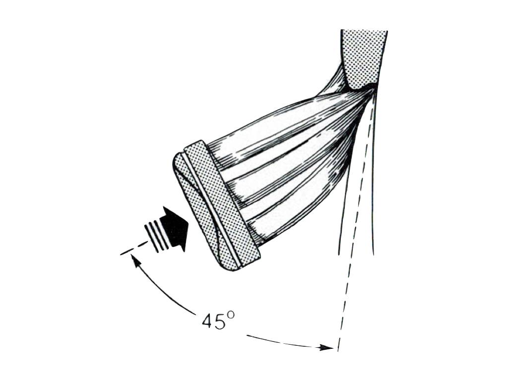 一辈子不洗牙的危害,一辈子不洗牙会有什么后果