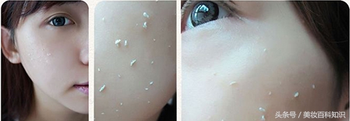 去角质的白色东西是什么,去角质搓出来的是死皮还是产品