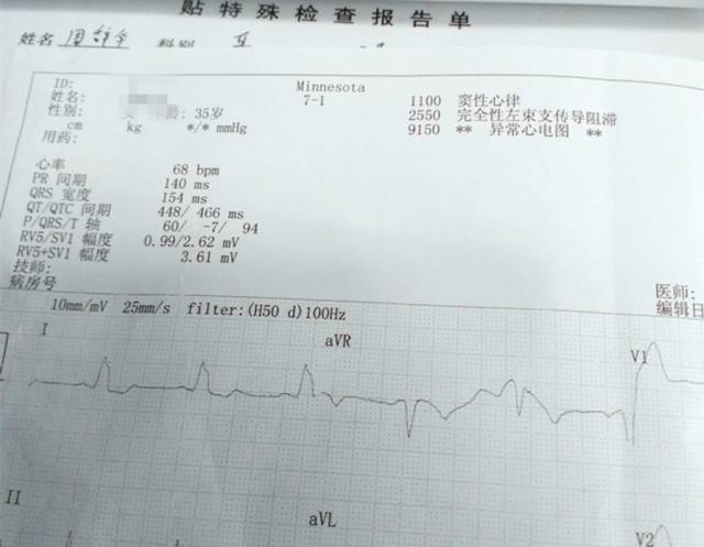 完全性左束支传导阻滞可以治愈吗,完全性左束支传导阻滞能否治愈