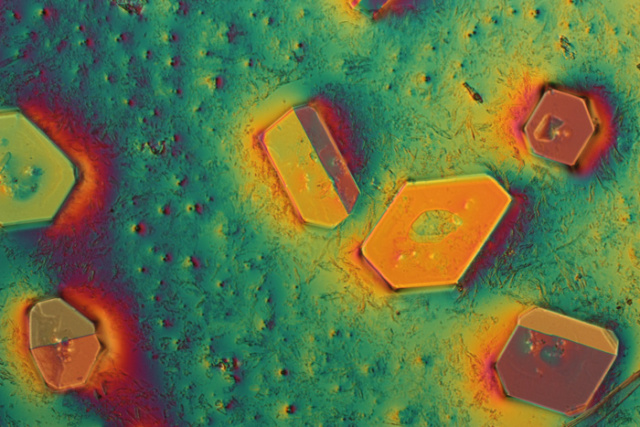 体检查出尿里有血是怎么回事,尿液检查结晶数量高是怎么回事