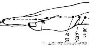 戒烟针灸的正确方法,针灸戒烟的穴位