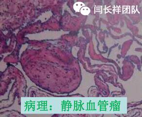 舌头突然不利索,舌头突然间不好使一会就好了